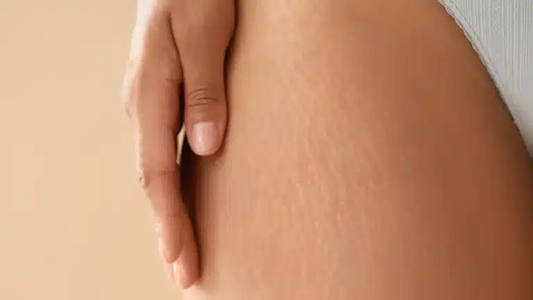 kako shujšati v noge in zmanjšati maščobo na stegnih